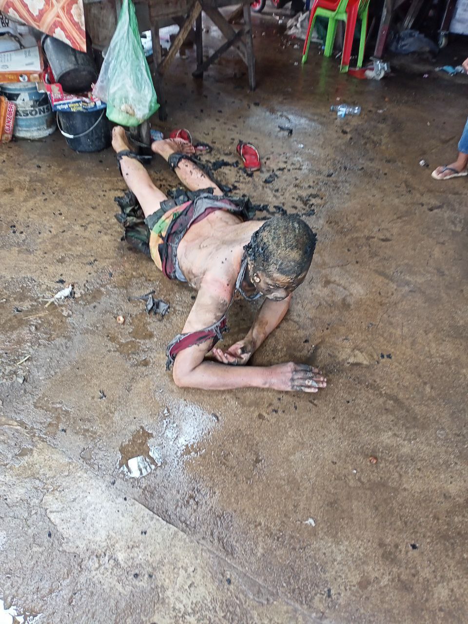 បុរសសតិមិនល្អម្នាក់ទិញសាំងយកមកដុតខ្លួនឯង បណ្តាលឱ្យរងរបួសធ្ងន់